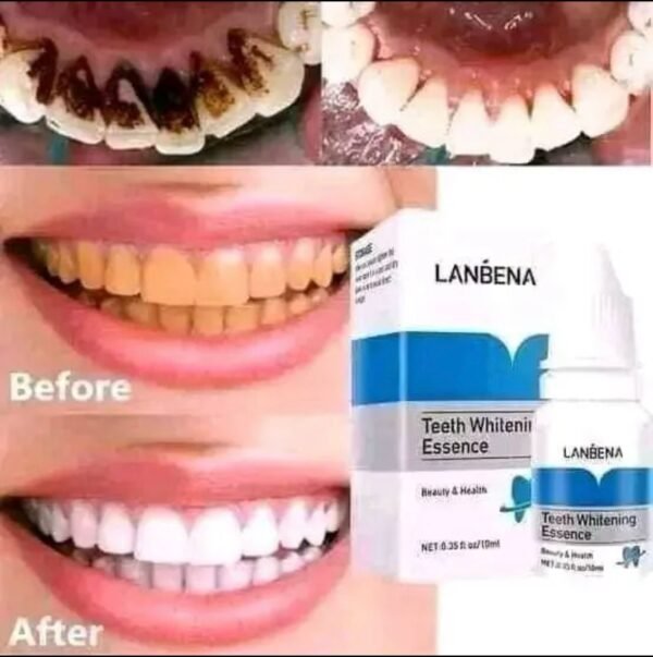 LANBENA Teeth Whitening Essence